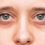 reduce dark circles and puffiness under your eyes